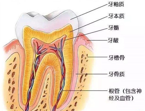 根管治疗剖析图