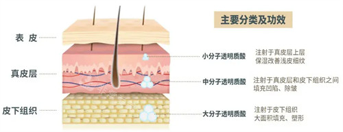 玻尿酸注射后皮肤变化