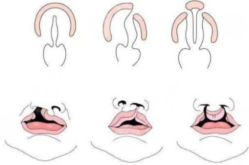 2026版：整理韩国鼻修复技术可靠医院名单！多次高难度修复不在话下！