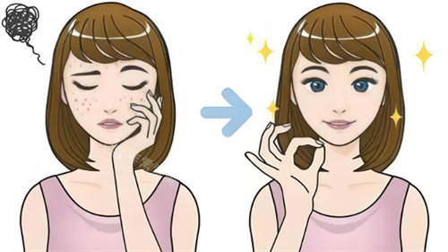 去痘印前后对比