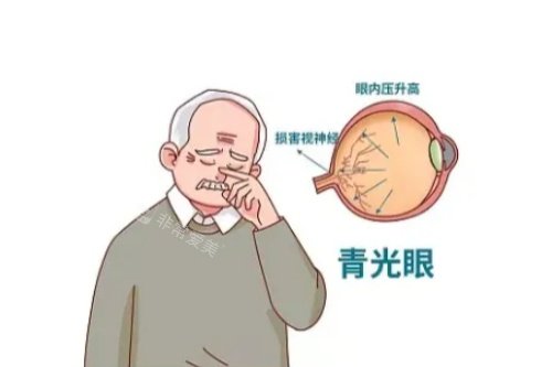 青光眼卡通一览图