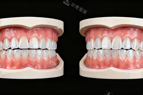 牙齿模型展示图