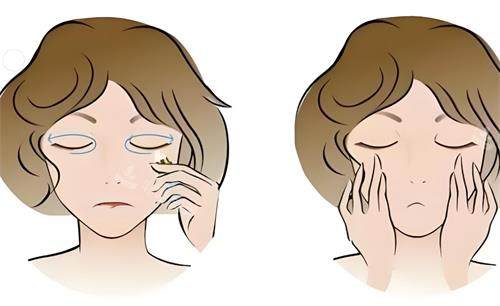 去眼袋前后对比动画图