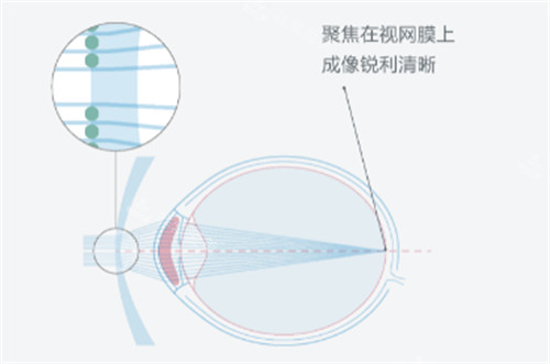 依视路星趣控镜片的优势图解