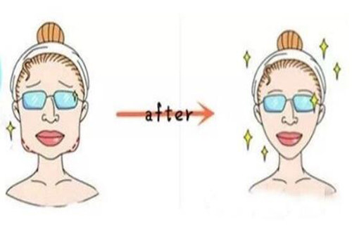 面部輪廓對比卡通