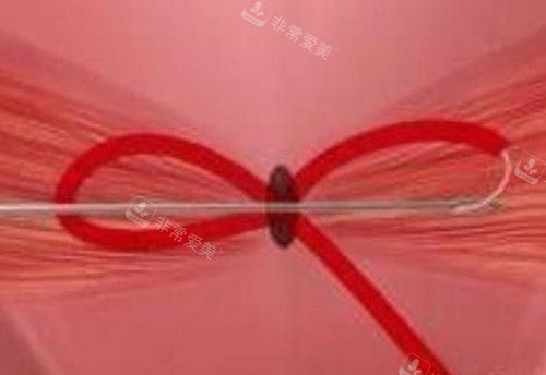 3d生物束带示意