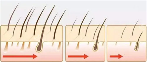 想知道温州雍禾种植毛发医院如何预约吗？在线问询即可免费预约，还有更多详情等你了解！