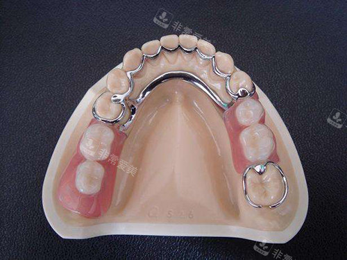牙齿义齿假牙模型
