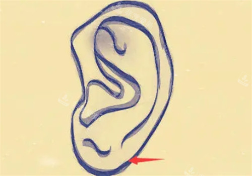 正常的耳垂形状