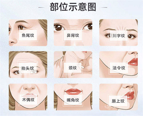 韩国面部除皱整形医院排名？网传Elev、梦想、MadeU、DayOne、ID医院上榜，技术靠前