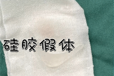 硅胶下巴假体照片