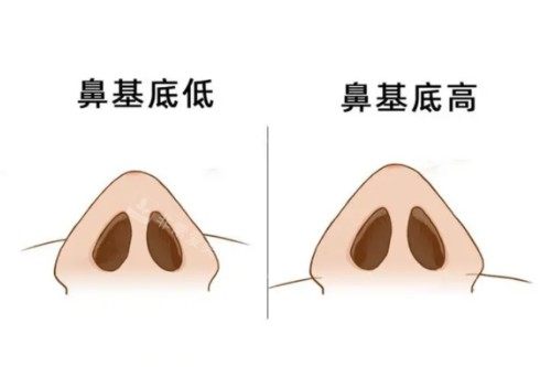 鼻基底展示图