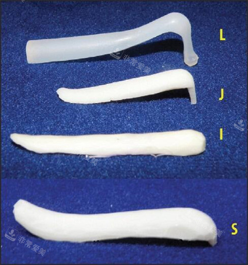 隆鼻假体的不同形态