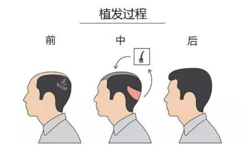 头顶加密过程示意图
