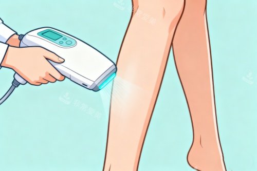 腿部做仪器吸脂卡通图