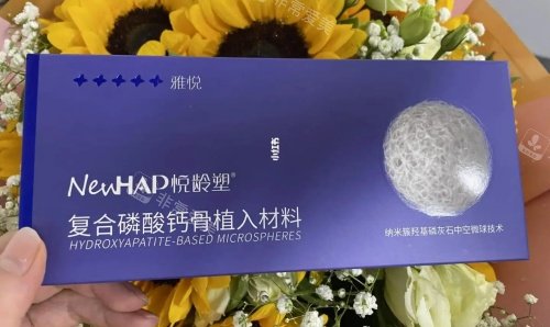 悦龄塑盒装示意图