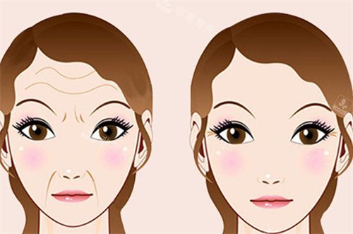 抗衰除皱 抗衰除皱