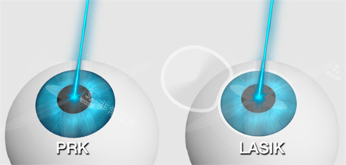 韩国江南acee眼科医院官网预约攻略！中文通道，免排队超便捷！