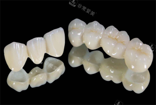 连冠的全瓷牙