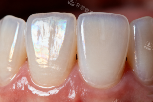 健康正常牙齿卡通图