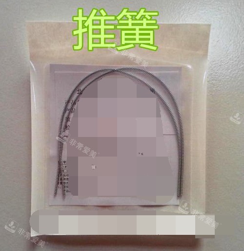牙齿矫正正畸推簧材料