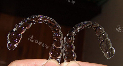 牙齿矫正隐形矫正牙套实物图