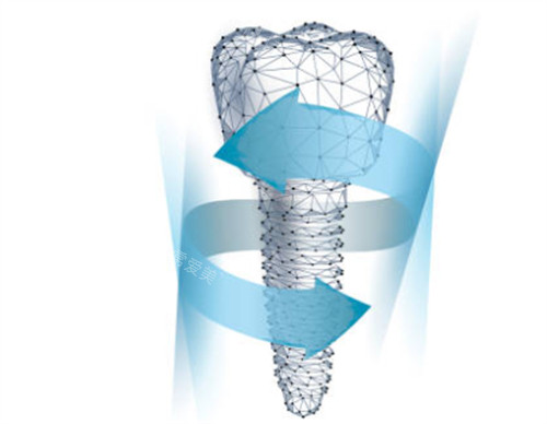 种植牙模型卡通图