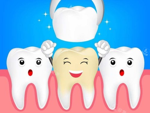 烤瓷牙义齿修复示意图