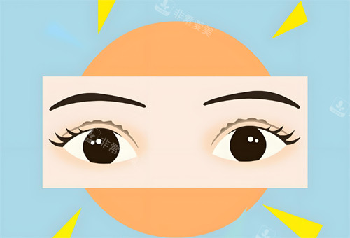 双眼皮睁开图 双眼皮睁开图