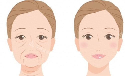 韩国奥拉克皮肤科项目结果好吗？正规！光电提升抗衰+注射填充美肌双重获益