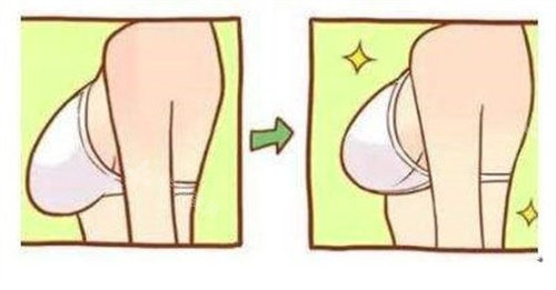 隆胸手术对比 隆胸手术对比