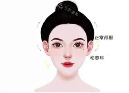 幼态脸的示意图 幼态脸的示意图