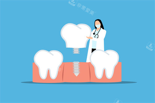 种植牙宣传图