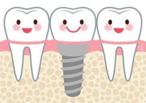 种植牙后动画展示图