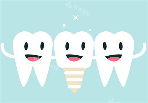 种植牙和健康牙齿图