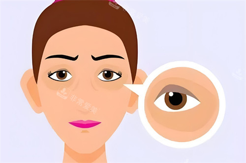 郑州王杨医生眼袋修复预约电话号码0371-56973999,郑州王杨医生眼袋修复分层悬吊与脂肪复位技术自然无痕!