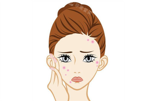 祛痘治疗卡通图