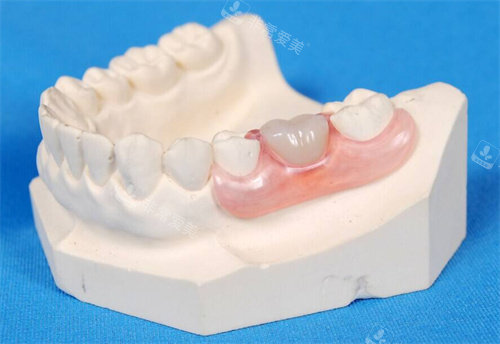 牙齿模型展示 图片