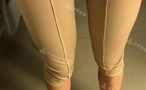 腿部塑身衣照片