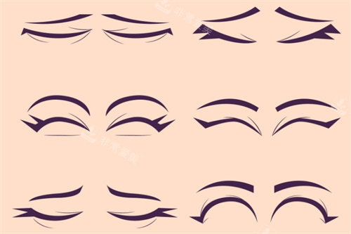 眼部整形术式对比