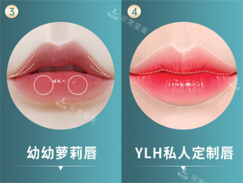 不同唇型展示