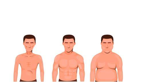 男性乳房肥大示意