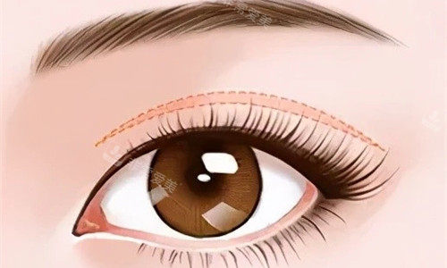 芜湖二四美整形怎么样?芜湖二四美医疗美容正规吗?公布简介地址和擅长项目！