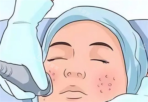 亲测韩国祛痘坑这些坑别踩！选对医院看FDA认证设备+首尔大背景医生，附机构资质查询攻