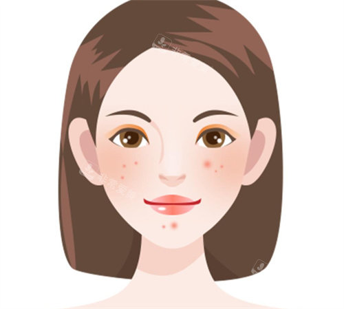 祛痘卡通展示图片 祛痘卡通展示图片