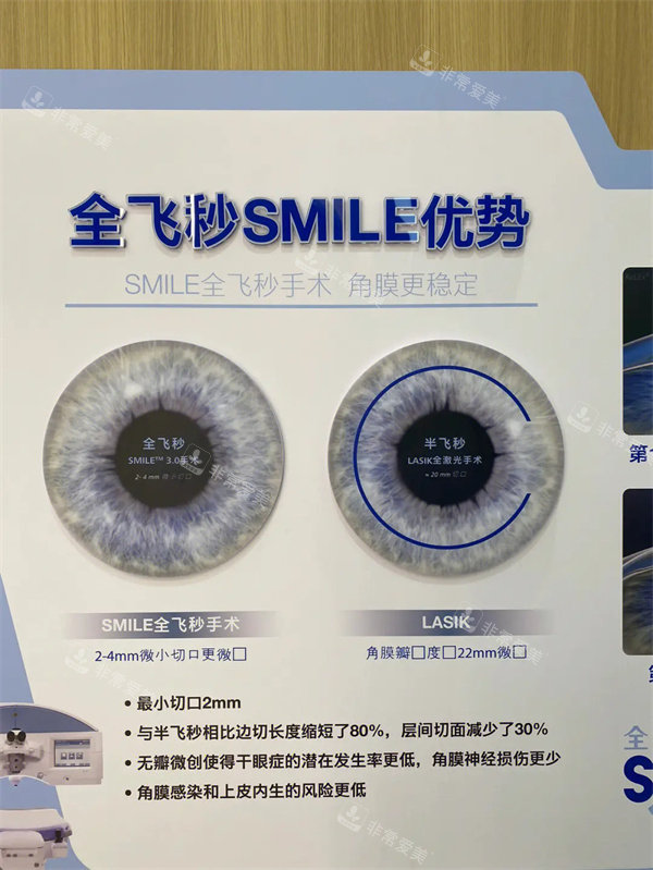 全飞秒SMILE优势