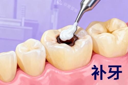 补牙卡通展示图