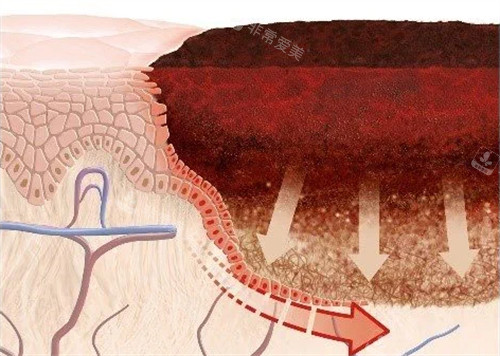 健康皮肤科和疤痕 健康皮肤科和疤痕
