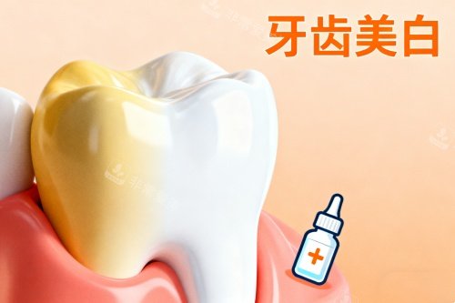 牙齿美白卡通图片展示