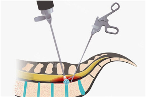首尔拉皮提升医院排行榜：真实实例丽婷/Faceplus/必当归让你精密抗衰年轻十岁！